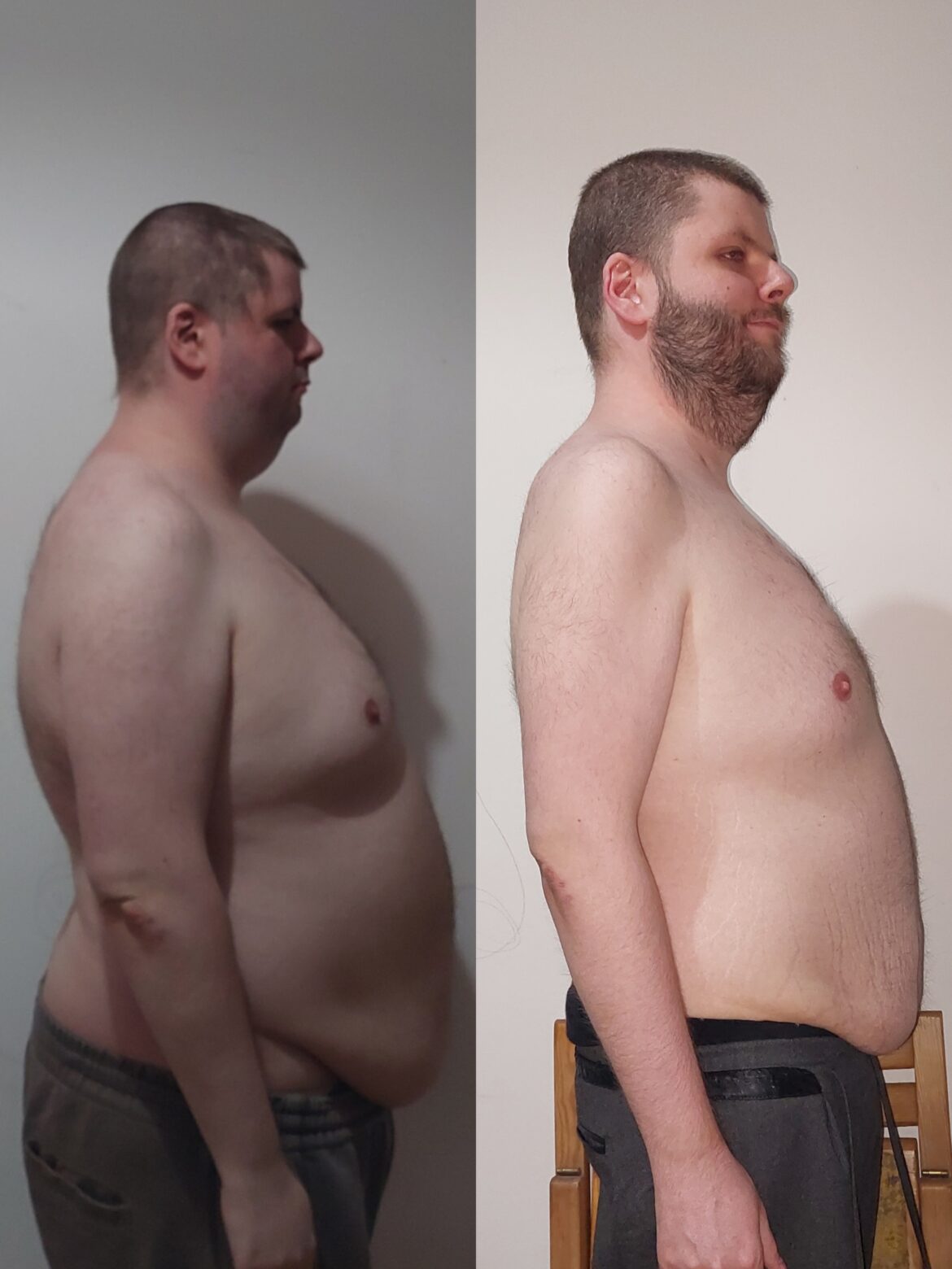 Moja najważniejsza metamorfoza. Od 115 kg do walki o życie i powrotu do sił