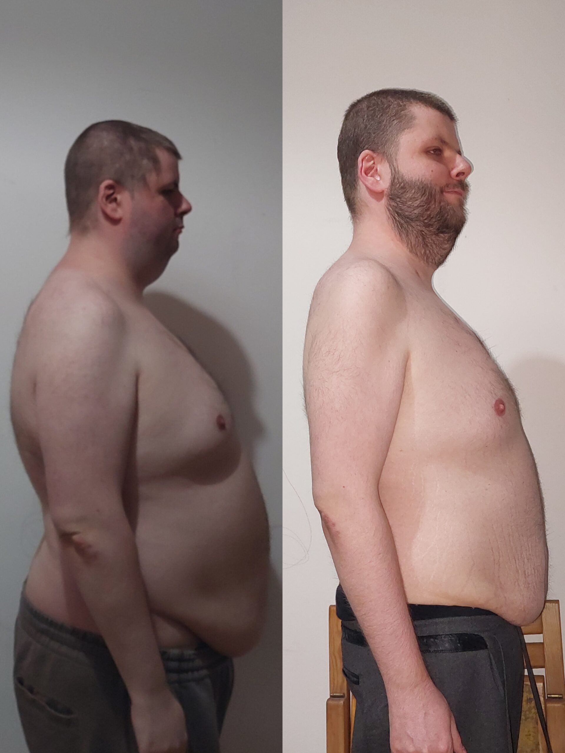 Moja najważniejsza metamorfoza. Od 115 kg do walki o życie i powrotu do sił
